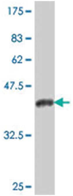 STAC, Mouse, Polyclonal Antibody, Abnova 50&mu;L; Unlabeled:Antibodies,