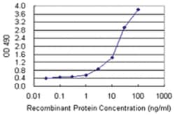 anti-STAT1 Matched Antibody Pair, Abnova