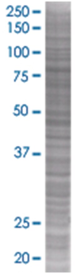 STAT1 293T Cell Overexpression Lysate (Denatured), Abnova 100 &mu;L | Buy Online | Abnova | Fisher Scientific