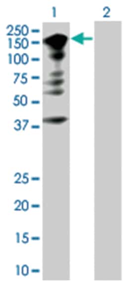 STAT1 293T Cell Overexpression Lysate (Denatured), Abnova 100 &mu;L | Buy Online | Abnova | Fisher Scientific