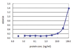anti-STAT5B, Human, Matched Antibody Pair, Abnova™