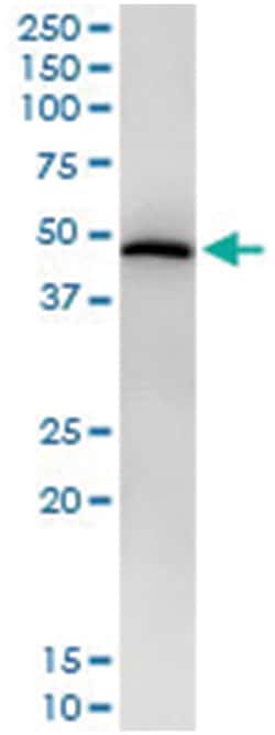 anti-STAT5B, Human, IP-WB Antibody Pair, Abnova&trade;