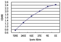 anti-STAT6 Matched Antibody Pair, Abnova 1 set, Unlabeled:Antibodies, Monoclonal/Polyclonal