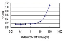 anti-SULT1E1 Matched Antibody Pair, Abnova 1 Set | Buy Online | Abnova | Fisher Scientific