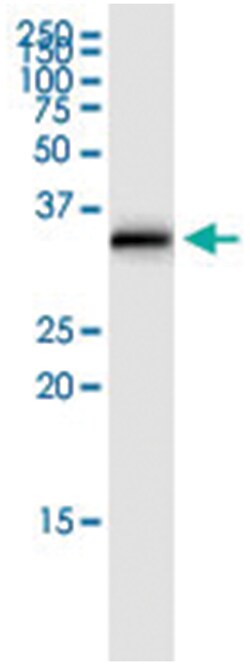 anti-SULT1E1, Human, IP-WB Antibody Pair, Abnova 1 Set:Antibodies, Monoclonal/Polyclonal