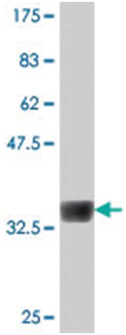 NEK4, Mouse, Polyclonal Antibody, Abnova 50 &mu;L | Buy Online | Abnova | Fisher Scientific