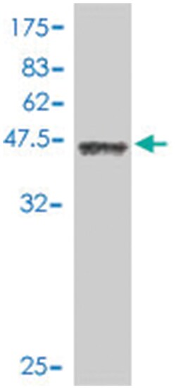 STK11, Mouse, Polyclonal Antibody, Abnova 50&mu;L; Unlabeled:Antibodies,