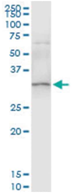 SULT1A1, Human, IP-WB Antibody Pair (PW2), Abnova&trade;