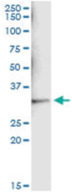 SULT1A1, Human, IP-WB Antibody Pair (PW3), Abnova™