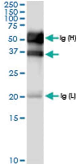 anti-SULT2B1, Human, IP-WB Antibody Pair, Abnova&trade;