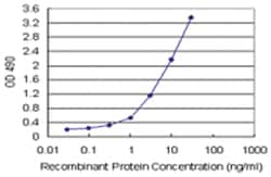 anti-SUOX Matched Antibody Pair, Abnova