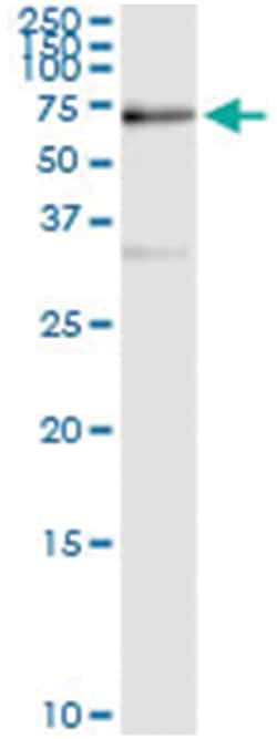 anti-SUOX, Human, IP-WB Antibody Pair, Abnova 1 Set:Antibodies, Monoclonal/Polyclonal