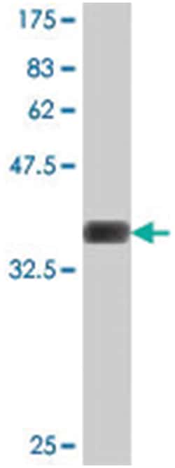 SVIL, Mouse, Polyclonal Antibody, Abnova 50 &mu;L | Buy Online | Abnova Corporation | Fisher Scientific