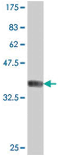SYN2, Mouse, Polyclonal Antibody, Abnova 50 &mu;L | Buy Online | Abnova Corporation | Fisher Scientific
