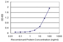 anti-T Matched Antibody Pair, Abnova