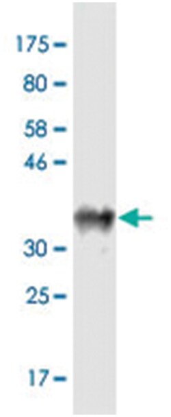 ADAM17, Mouse, Clone: 1F6, Abnova 200&mu;L; Unlabeled:Antibodies, Monoclonal