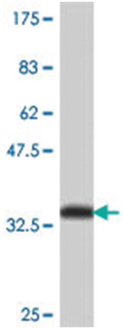 TACR1, Mouse, Polyclonal Antibody, Abnova 50&mu;L; Unlabeled:Antibodies,