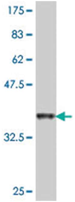 TAF4, Mouse, Polyclonal Antibody, Abnova 50&mu;L; Unlabeled:Antibodies,