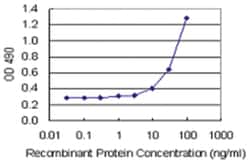TAGLN, Human, Matched Antibody Pair (AP43), Abnova™