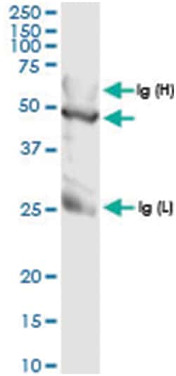 anti-TALDO1, Human, IP-WB Antibody Pair, Abnova&trade;