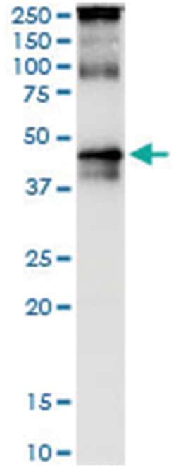 TARBP2, Human, IP-WB Antibody Pair (PW3), Abnova 1 Set:Antibodies, Monoclonal/Polyclonal