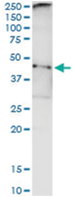 TARBP2, Human, IP-WB Antibody Pair (PW4), Abnova&trade;