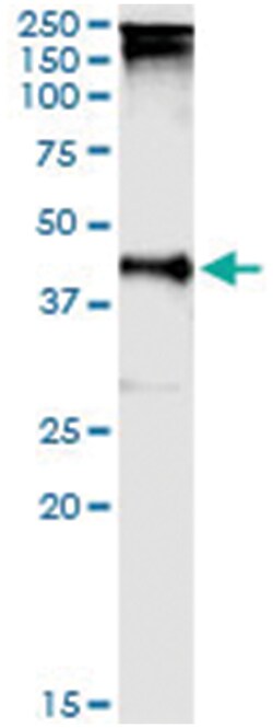 TARBP2, Human, IP-WB Antibody Pair (PW5), Abnova&trade;