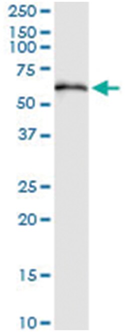 anti-TBCE, Human, IP-WB Antibody Pair, Abnova&trade;