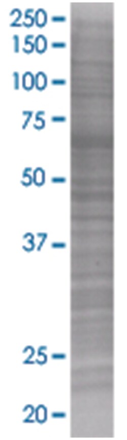 TCF2 293T Cell Overexpression Lysate (Denatured), Abnova 100 &mu;l | Buy Online | Abnova | Fisher Scientific