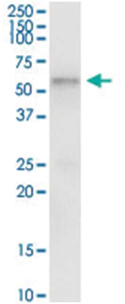 TCN1, Human, IP-WB Antibody Pair (PW3), Abnova&trade;