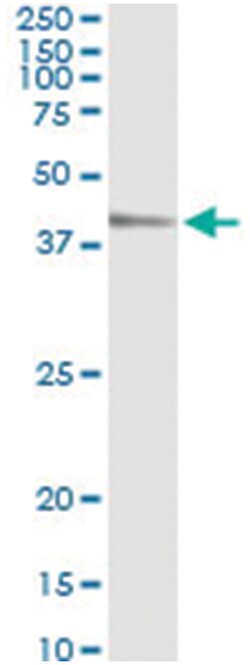 anti-TEAD4, Human, IP-WB Antibody Pair, Abnova&trade;