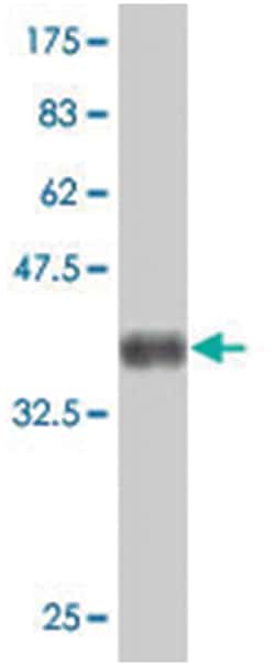 TECTA, Mouse, Polyclonal Antibody, Abnova 50&mu;L; Unlabeled:Antibodies,