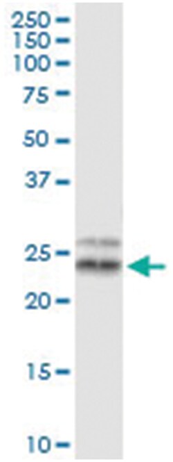 anti-TFAM, Human, IP-WB Antibody Pair, Abnova 1 Set:Antibodies, Monoclonal/Polyclonal