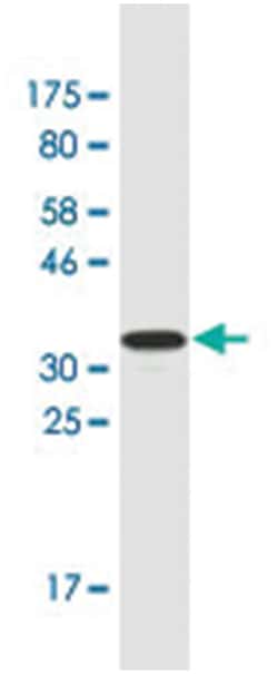 NR2F2, Mouse, Clone: 2G12, Abnova 200&mu;L; Unlabeled:Antibodies, Monoclonal