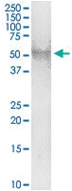 anti-NR2F2, Human, IP-WB Antibody Pair, Abnova 1 Set:Antibodies, Monoclonal/Polyclonal
