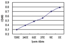 anti-TGFB1I1 Matched Antibody Pair, Abnova 1 set, Unlabeled:Antibodies,