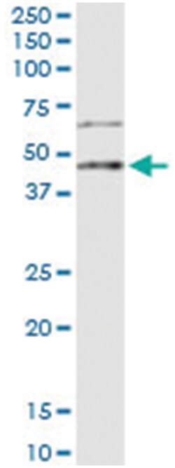 Abnova anti-LEFTY2, Human, IP-WB Antibody Pair, Abnova™