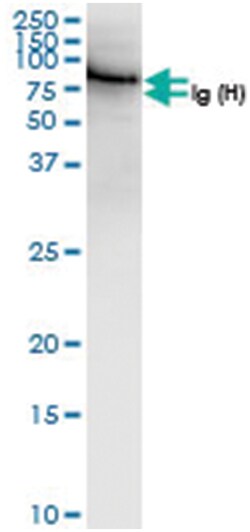 anti-TGFBI, Human, IP-WB Antibody Pair, Abnova™