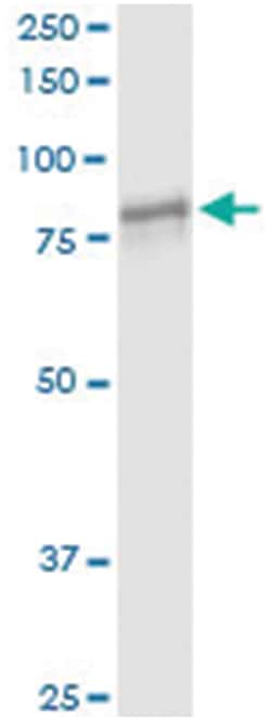 anti-TGM1, Human, IP-WB Antibody Pair, Abnova 1 Set:Antibodies, Monoclonal/Polyclonal