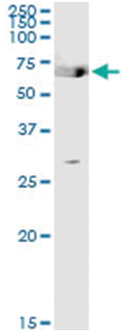 anti-TGM2, Human, IP-WB Antibody Pair, Abnova&trade;