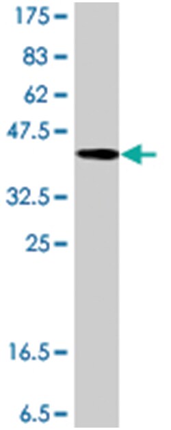 THY1, Mouse, Polyclonal Antibody, Abnova 50 &mu;L | Buy Online | Abnova | Fisher Scientific