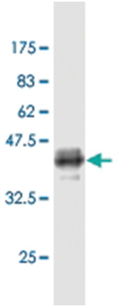 KLF10, Mouse, Clone: 2E11, Abnova 100&mu;g; Unlabeled:Antibodies, Monoclonal