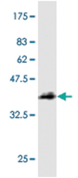 KLF10, Mouse, Clone: 3F1, Abnova 100 &mu;g | Buy Online | Abnova | Fisher Scientific