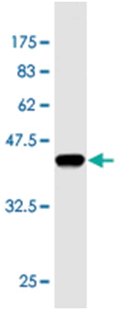 KLF10, Mouse, Clone: 5G9, Abnova 100&mu;g; Unlabeled:Antibodies, Monoclonal
