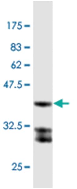 KLF10 (M65), Mouse anti-Human, Clone: 7C1, Abnova 100&mu;g; Unlabeled:Antibodies,