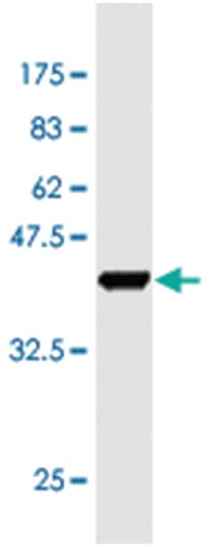 KLF10, Mouse, Clone: 8F12, Abnova 100&mu;g; Unlabeled:Antibodies, Monoclonal