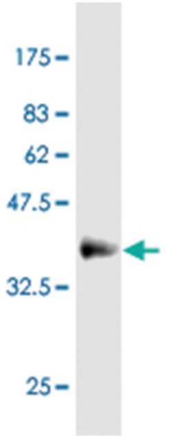 KLF10 (M74), Mouse anti-Human, Clone: 3A10, Abnova 100&mu;g; Unlabeled:Antibodies,