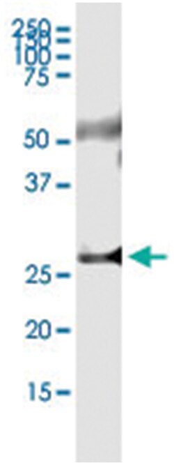 anti-TIA1, Human, IP-WB Antibody Pair, Abnova 1 Set:Antibodies, Monoclonal/Polyclonal