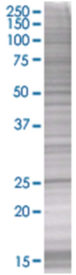 TIA1 293T Cell Overexpression Lysate (Denatured), Abnova