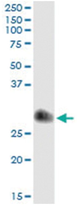 anti-TIMP1, Human, IP-WB Antibody Pair, Abnova&trade;